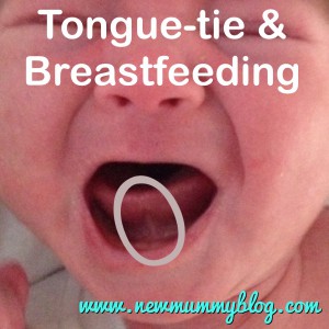 newmummyblog tongue-tie and problems breastfeeding