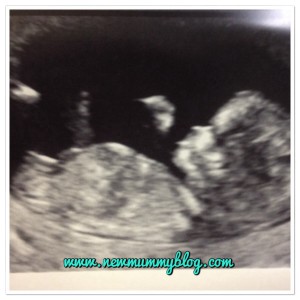 Baby 2 scan 