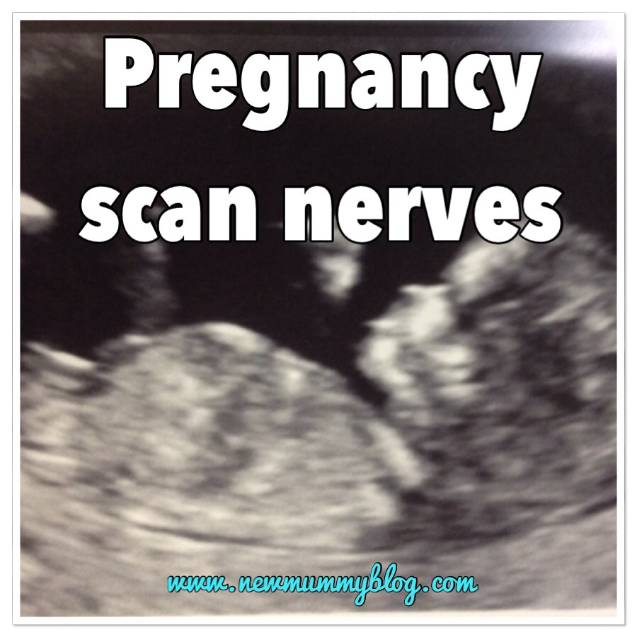 Baby scan photo heartfelt pregnancy scan nerves